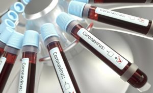 28.11.2020 Incidența privind infectarea cu coronavirus continuă panta descendentă