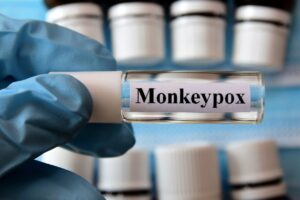 Ministerul Sănătăţii: Un nou caz de variola maimuței în România 