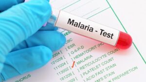 Recomandări MAE pentru românii care călătoresc în țări cu risc ridicat de malarie